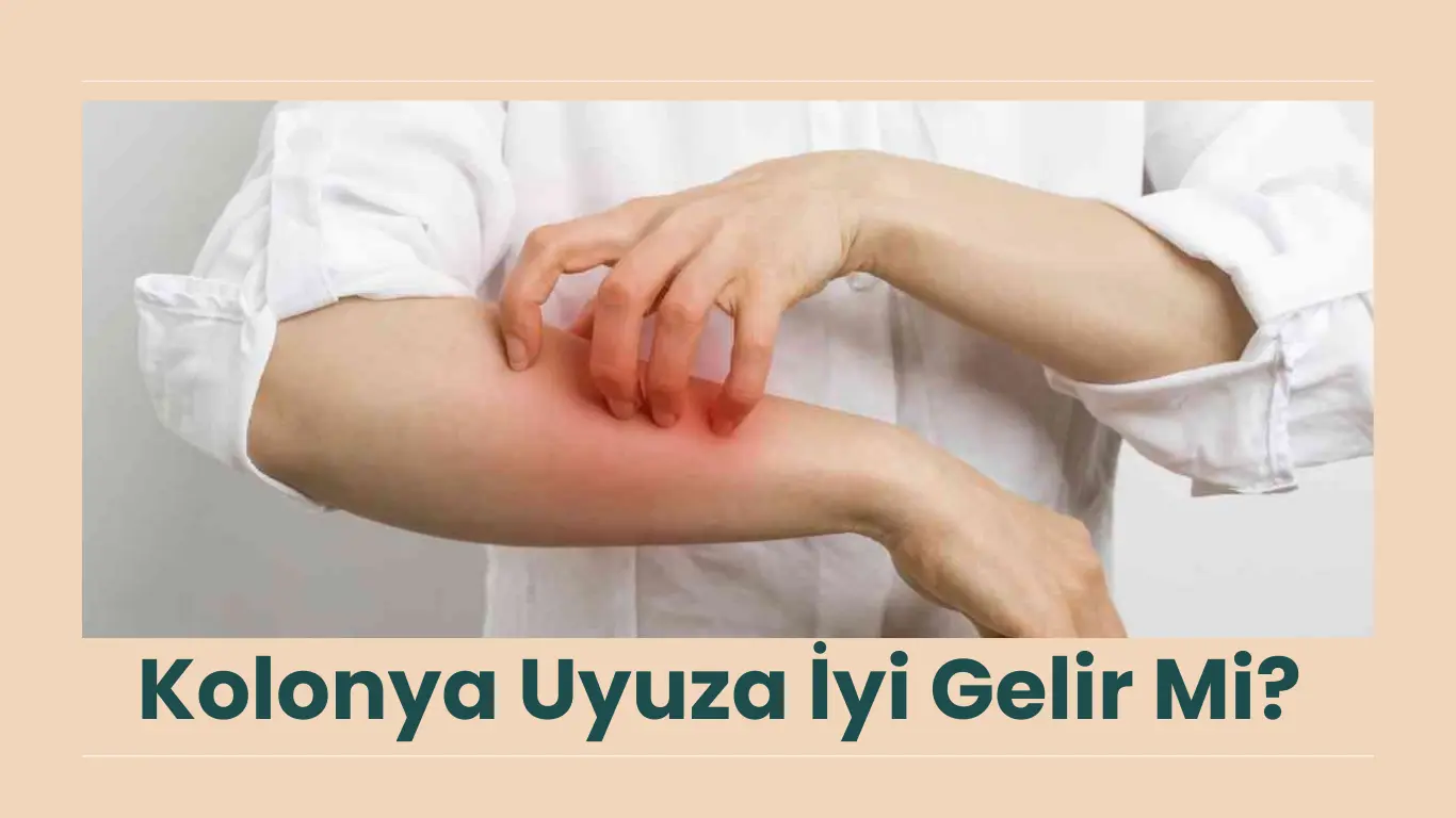 Kolonya Uyuza İyi Gelir Mi? Tedavi Yöntemleri